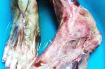 Chinese restaurant accused of serving HUMAN FEET SHOCKING