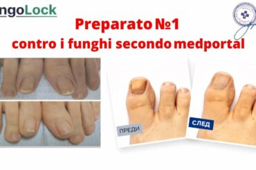 Fungolock Prezzo, Fungolock Italy Prezzo