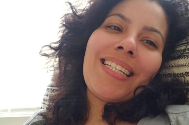 Day 9 Post OP Tummy Tuck Looking Good