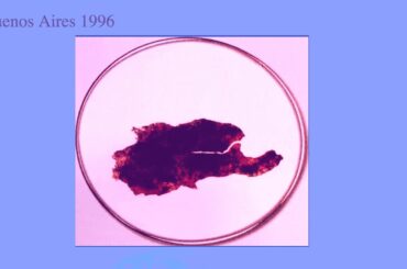 11. Eucharistic Miracles Lanciano, Italy and Buenos Aires, Argentina