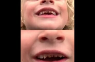 Taina, Your Children Need REAL Food - (Tooth Decay, Malnourishment? Taina  Licciardo-Toivola)