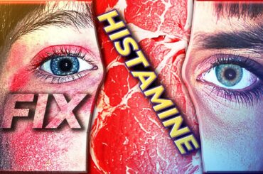 How I fixed my Histamine Intolerance