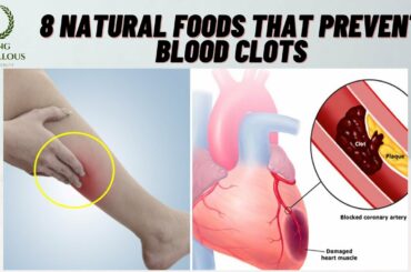 8 Best Blood Thinner Foods