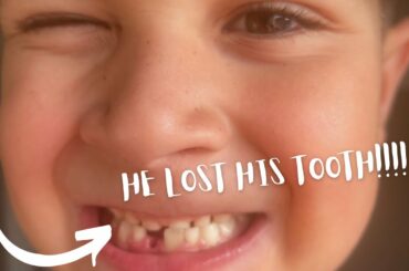 HE LOST HIS TOOTH ! | ITALIAN FOOD | MAKING PROGRESS ON OUR TRIP