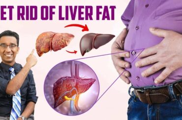 How to DETOX your FATTY liver without medications? | Dr Pal