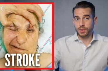 Biggest RISK Factor For STROKE